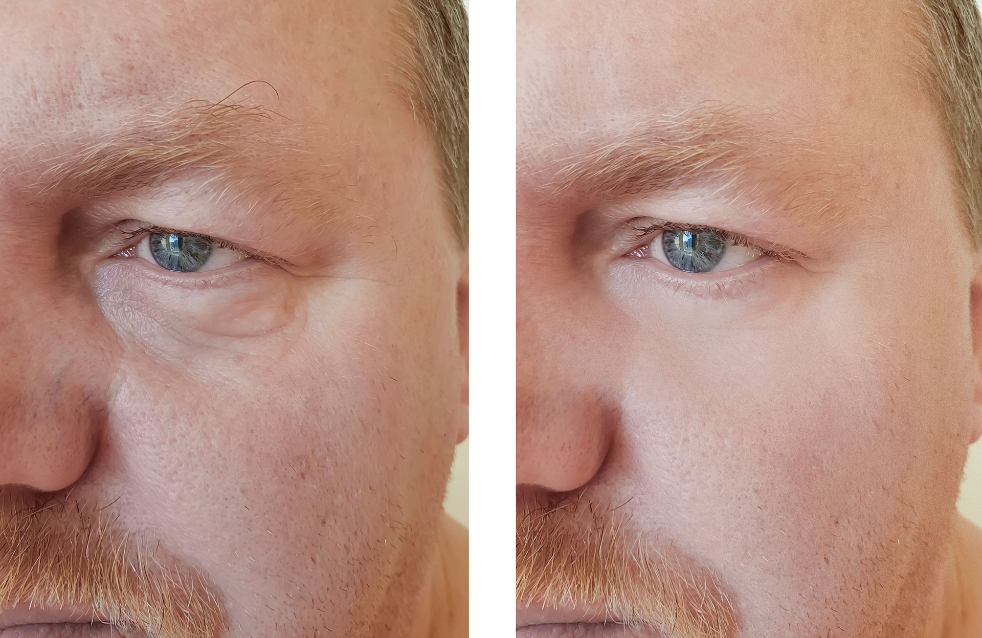 Injection pour les hommes à Paris par le dr Nguyen