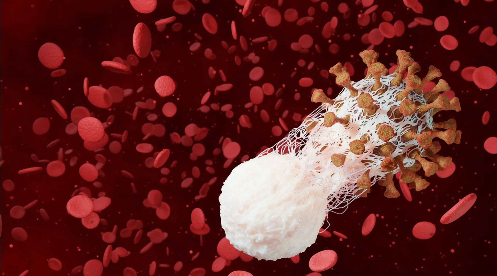 Acupuncture et GVHD par le dr Nguyen